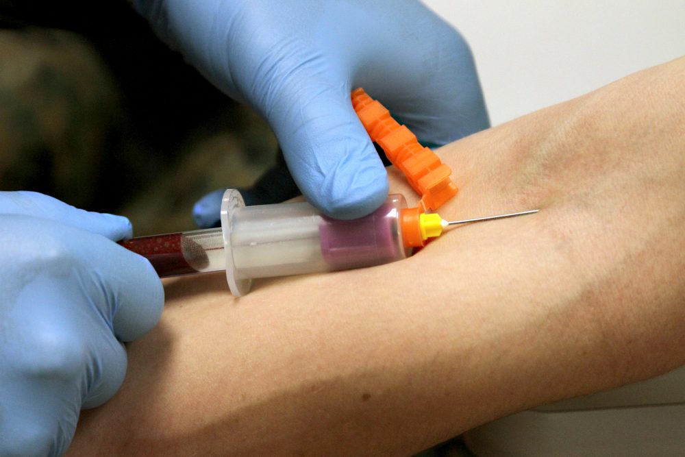 A Blood Test That Detects Cancer Years Ahead Of Symptoms Could Save 