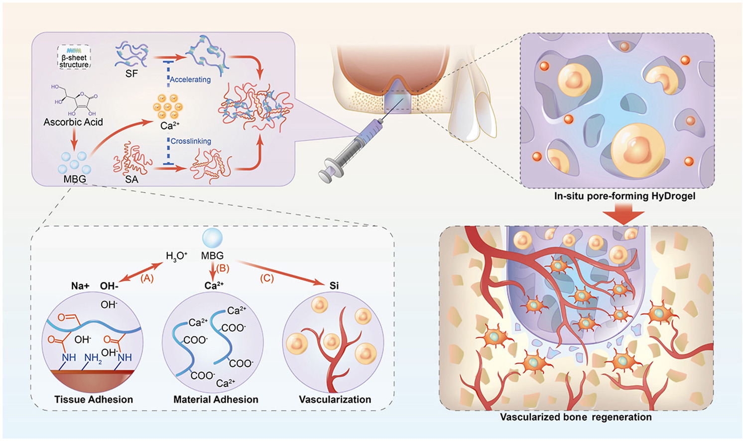 Injectable Hydrogel: A Breakthrough in Bone Healing and Regeneration