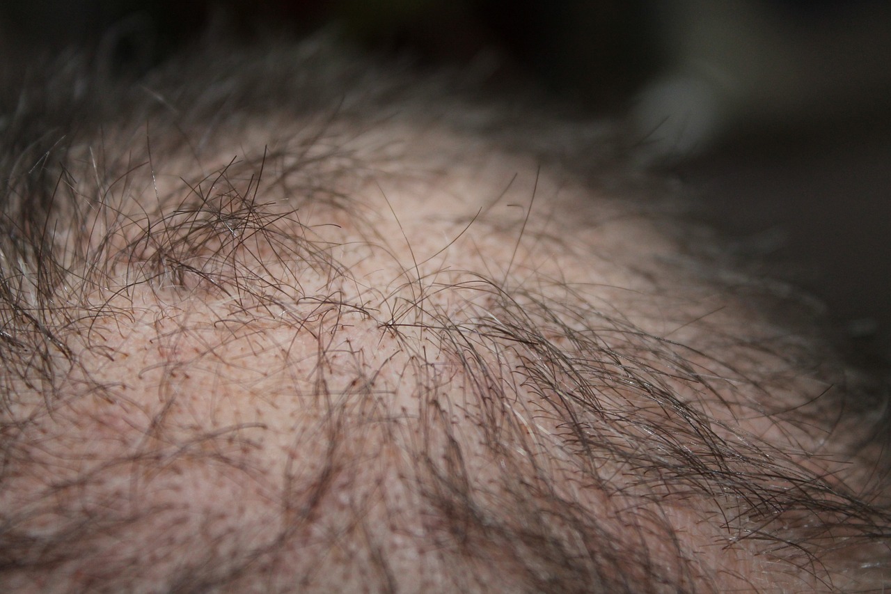 Revolutionary Hair Loss Treatment: This Simple Sugar Gel Shows Surprising Results